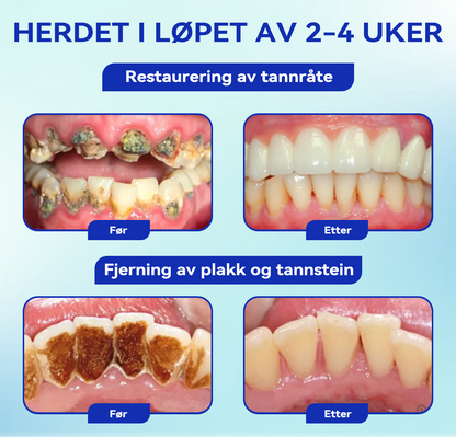𝐁𝐢𝐤𝐞𝐧𝐝𝐚™💥💥 𝐅𝐨𝐜𝐮𝐬 𝐒𝐦𝐢𝐥𝐞 Tannpleie Mundpulver (👩🏻‍⚕️ Anbefalt av tannlegeforeningen)