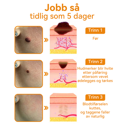 🎈𝐕𝐬𝐨𝐱𝐚™ 𝐁𝐢𝐞𝐠𝐢𝐟𝐭 𝐕𝐨𝐫𝐭𝐞 𝐅ø𝐟𝐥𝐞𝐤𝐤𝐬𝐟𝐣𝐞𝐫𝐧𝐢𝐧𝐠 𝐊𝐫𝐞𝐦⚡⚡(𝐒𝐢𝐬𝐭𝐞 𝐬𝐚𝐥𝐠𝐬𝐝𝐚𝐠, 𝟖𝟎 % 𝐚𝐯𝐬𝐥𝐚𝐠)