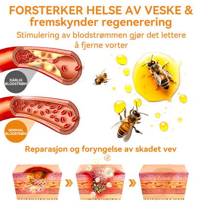 🍁💖𝐕𝐬𝐨𝐱𝐚™ 𝐁𝐢𝐞𝐠𝐢𝐟𝐭 𝐕𝐨𝐫𝐭𝐞 𝐅ø𝐟𝐥𝐞𝐤𝐤𝐬𝐟𝐣𝐞𝐫𝐧𝐢𝐧𝐠 𝐊𝐫𝐞𝐦⚡⚡(𝐒𝐢𝐬𝐭𝐞 𝐬𝐚𝐥𝐠𝐬𝐝𝐚𝐠, 𝟖𝟎 % 𝐚𝐯𝐬𝐥𝐚𝐠)