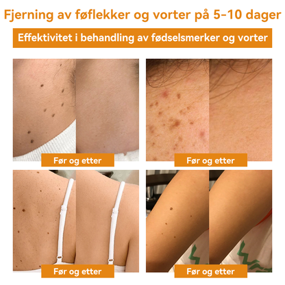 🎈𝐕𝐬𝐨𝐱𝐚™ 𝐁𝐢𝐞𝐠𝐢𝐟𝐭 𝐕𝐨𝐫𝐭𝐞 𝐅ø𝐟𝐥𝐞𝐤𝐤𝐬𝐟𝐣𝐞𝐫𝐧𝐢𝐧𝐠 𝐊𝐫𝐞𝐦⚡⚡(𝐒𝐢𝐬𝐭𝐞 𝐬𝐚𝐥𝐠𝐬𝐝𝐚𝐠, 𝟖𝟎 % 𝐚𝐯𝐬𝐥𝐚𝐠)