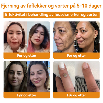 🎈💘𝐕𝐬𝐨𝐱𝐚™ 𝐁𝐢𝐞𝐠𝐢𝐟𝐭 𝐕𝐨𝐫𝐭𝐞 𝐅ø𝐟𝐥𝐞𝐤𝐤𝐬𝐟𝐣𝐞𝐫𝐧𝐢𝐧𝐠 𝐊𝐫𝐞𝐦⚡⚡(𝐒𝐢𝐬𝐭𝐞 𝐬𝐚𝐥𝐠𝐬𝐝𝐚𝐠, 𝟖𝟎 % 𝐚𝐯𝐬𝐥𝐚𝐠)