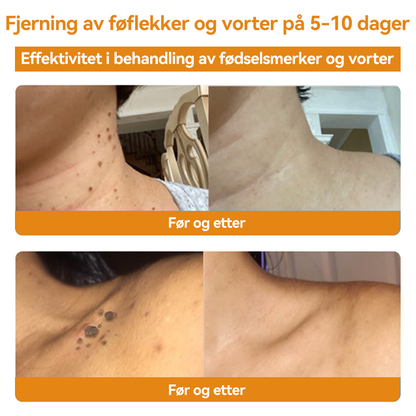 🎈𝐕𝐬𝐨𝐱𝐚™ 𝐁𝐢𝐞𝐠𝐢𝐟𝐭 𝐕𝐨𝐫𝐭𝐞 𝐅ø𝐟𝐥𝐞𝐤𝐤𝐬𝐟𝐣𝐞𝐫𝐧𝐢𝐧𝐠 𝐊𝐫𝐞𝐦⚡⚡(𝐒𝐢𝐬𝐭𝐞 𝐬𝐚𝐥𝐠𝐬𝐝𝐚𝐠, 𝟖𝟎 % 𝐚𝐯𝐬𝐥𝐚𝐠)
