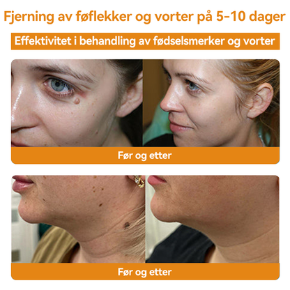 🎈𝐕𝐬𝐨𝐱𝐚™ 𝐁𝐢𝐞𝐠𝐢𝐟𝐭 𝐕𝐨𝐫𝐭𝐞 𝐅ø𝐟𝐥𝐞𝐤𝐤𝐬𝐟𝐣𝐞𝐫𝐧𝐢𝐧𝐠 𝐊𝐫𝐞𝐦⚡⚡(𝐒𝐢𝐬𝐭𝐞 𝐬𝐚𝐥𝐠𝐬𝐝𝐚𝐠, 𝟖𝟎 % 𝐚𝐯𝐬𝐥𝐚𝐠)