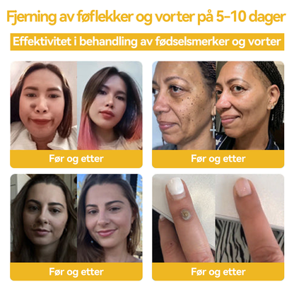 🥇🥇𝑭𝑹𝑶𝑷𝑼𝑵™ 𝑩𝒊𝒆𝒈𝒊𝒇𝒕𝑭ø𝒇𝒍𝒆𝒌𝒌- 𝒐𝒈 𝒗𝒐𝒓𝒕𝒆𝒃𝒆𝒉𝒂𝒏𝒅𝒍𝒊𝒏𝒈𝒔𝒌𝒓𝒆𝒎(🔥𝑺𝒊𝒔𝒕𝒆 𝒅𝒂𝒈 𝒇𝒐𝒓 𝒌𝒂𝒎𝒑𝒂𝒏𝒋𝒆𝒏, 80% 𝒓𝒂𝒃𝒂𝒕𝒕)