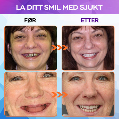 𝐁𝐢𝐤𝐞𝐧𝐝𝐚™ 🦓𝑆𝐼𝐿𝐼𝐾𝑂𝑁 𝑅𝐸𝐿𝐼𝑁𝐸 𝑇𝐴𝑁𝑁𝑆𝐸𝑇𝑇 (⏰ Tidsbegrenset rabatt Siste 30 minutter ⏰)