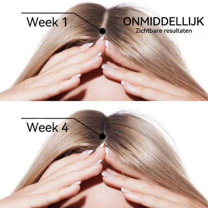 🌿👨‍⚕️ Officiële NL winkel  | 🔥𝐓𝐨𝐜𝐥𝐯𝐨®🌼💖𝐁𝐢𝐨𝐭𝐢𝐧𝐞 𝐑𝐨𝐳𝐞𝐦𝐚𝐫𝐢𝐣𝐧 𝐈𝐬 𝐙𝐞𝐞𝐫 𝐄𝐟𝐟𝐞𝐜𝐭𝐢𝐞𝐟 𝐇𝐚𝐚𝐫𝐠𝐫𝐨𝐞𝐢𝐬𝐞𝐫𝐮𝐦 — (🔥 Tijdelijke aanbieding⏳ Laatste dag van de actie: 50% KORTING)